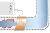 Vulcan against bacteria